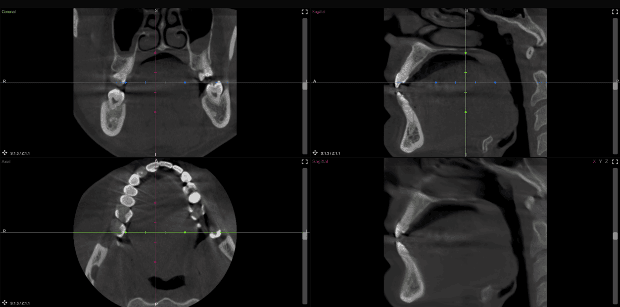 Grayscale version of kittens in a basket looking around.